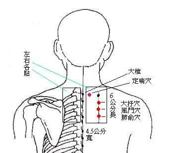 背部穴位圖